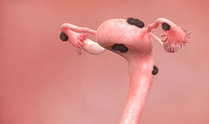 Imagem ilustrativa do embrião