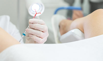 Profissional de saúde segurando seringa para inserir DIU e o Implante Subdérmico na paciente