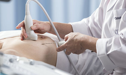 Profissional de saúde realizando ultrassonografia e utilizando a técnica de aspiração por agulha fina no paciente