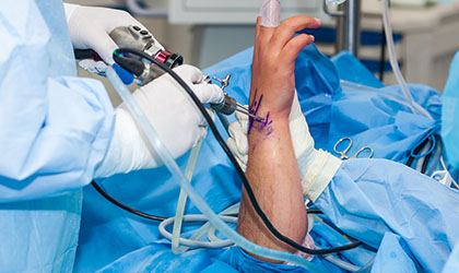 Procedimento cirúrgico no punho de um paciente