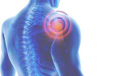 Radiografia das costas de uma pessoa com foco nas articulações do ombro.