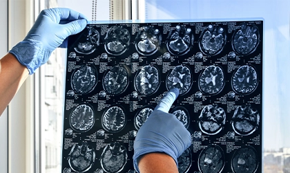 Curso de Neurorradiologia – Anatomia, Sequências Básicas e Malformações
