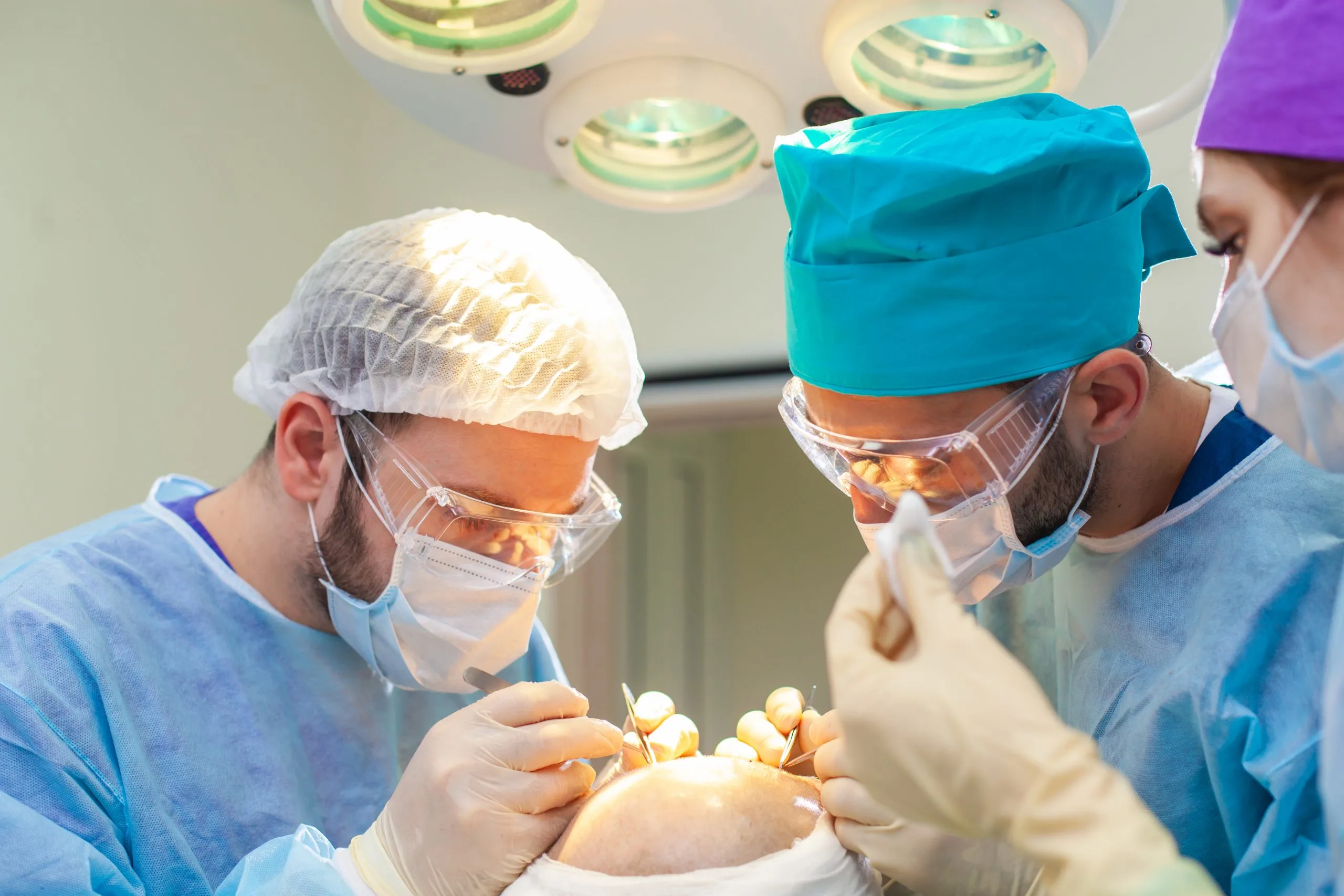 Cirurgiões fazendo transplante capilar em um paciente em uma sala de operação.